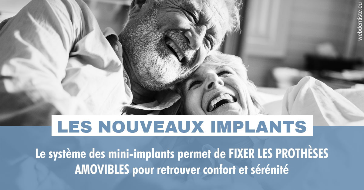 https://dr-jullien-ludovic.chirurgiens-dentistes.fr/Les nouveaux implants 2