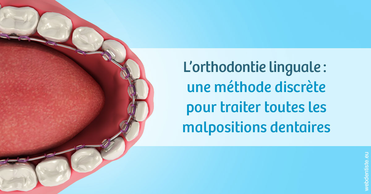https://dr-jullien-ludovic.chirurgiens-dentistes.fr/L'orthodontie linguale 1