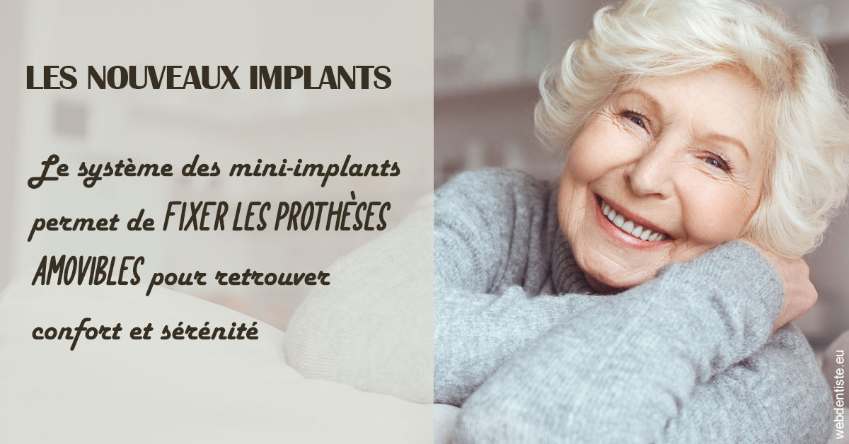 https://dr-jullien-ludovic.chirurgiens-dentistes.fr/Les nouveaux implants 1