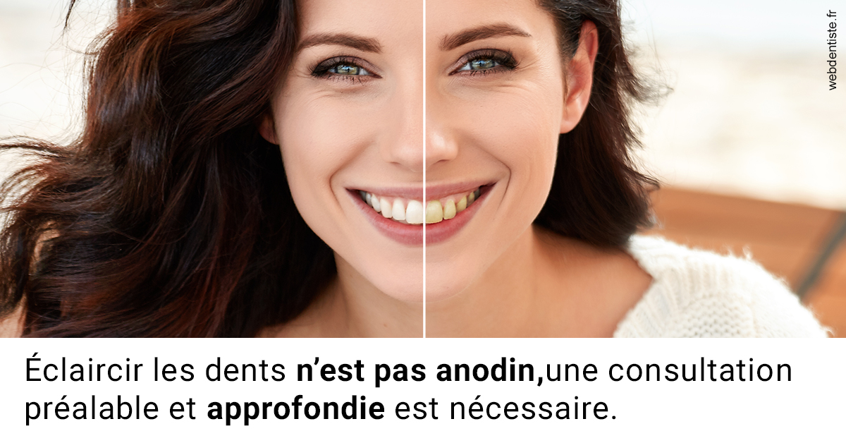 https://dr-jullien-ludovic.chirurgiens-dentistes.fr/Le blanchiment 2