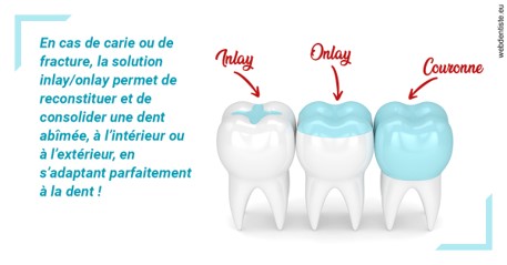 https://dr-jullien-ludovic.chirurgiens-dentistes.fr/L'INLAY ou l'ONLAY