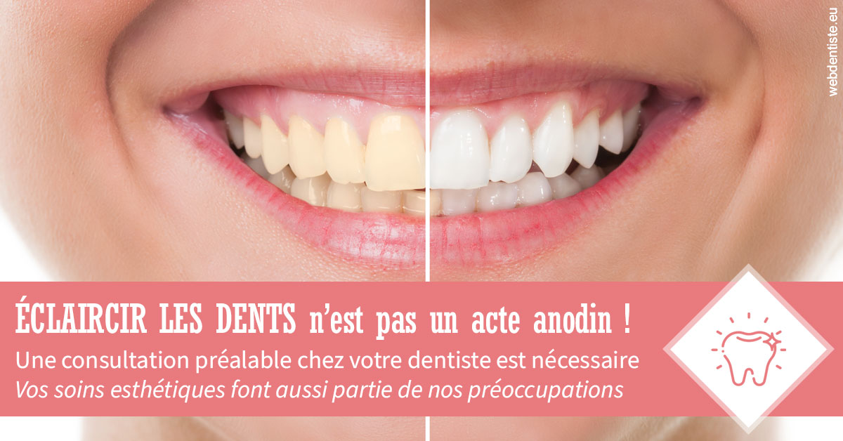 https://dr-jullien-ludovic.chirurgiens-dentistes.fr/Eclaircir les dents 1