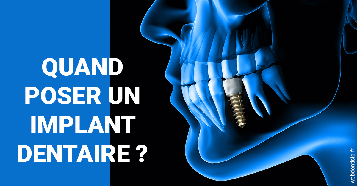 https://dr-jullien-ludovic.chirurgiens-dentistes.fr/Les implants 1