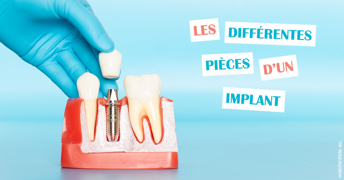 https://dr-jullien-ludovic.chirurgiens-dentistes.fr/Les différentes pièces d’un implant 2