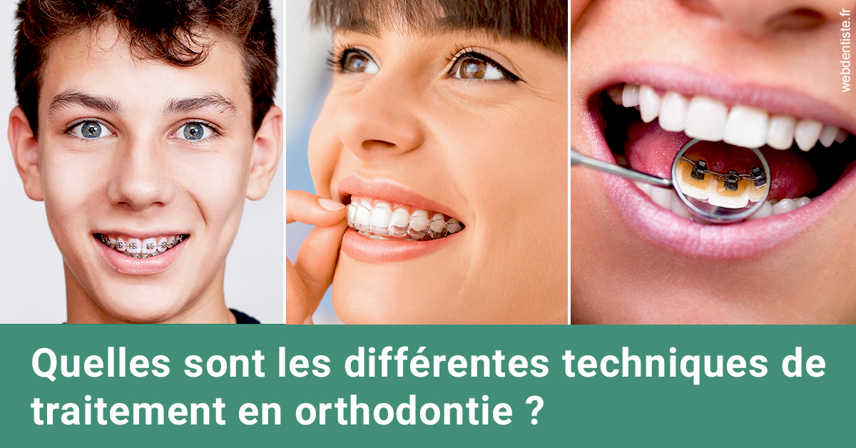 https://dr-jullien-ludovic.chirurgiens-dentistes.fr/Les différentes techniques de traitement 2
