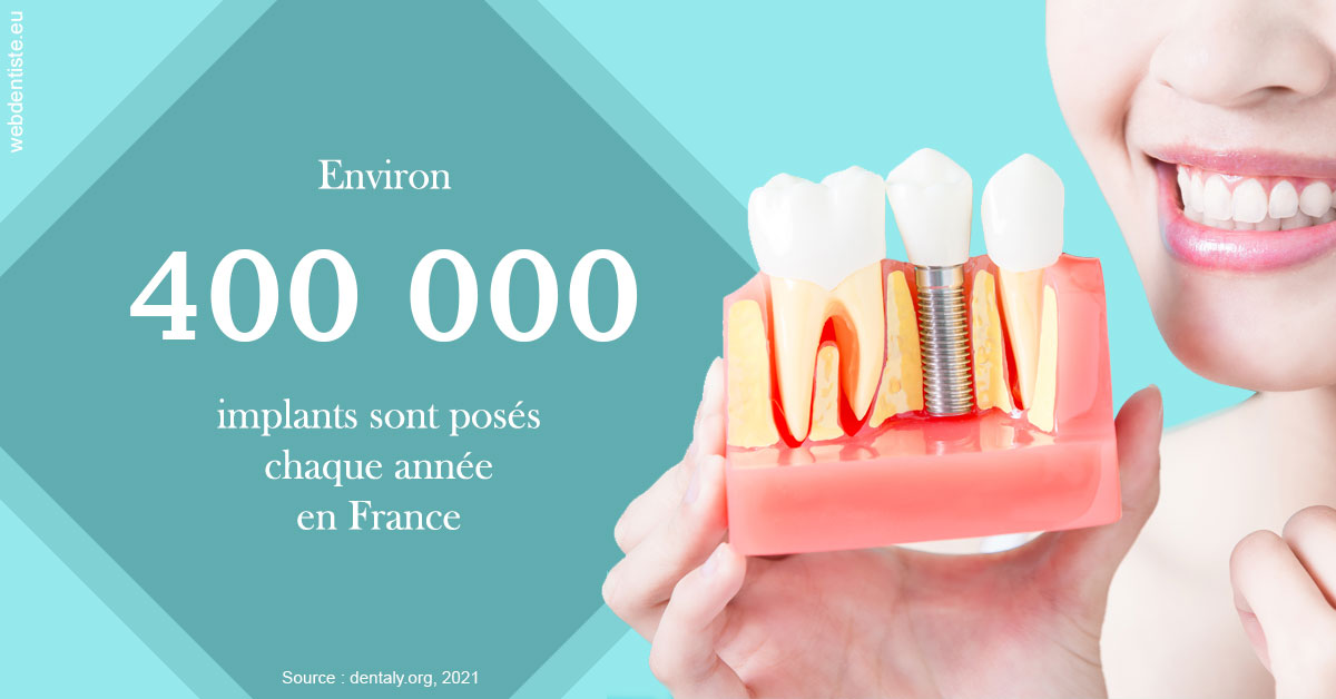 https://dr-jullien-ludovic.chirurgiens-dentistes.fr/Pose d'implants en France 2